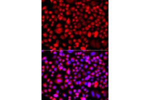 Immunofluorescence analysis of A549 cell using ALG1 antibody. (ALG1 antibody)