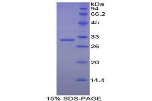 SDS-PAGE analysis of Human Early B-Cell Factor 2 Protein. (EBF2 Protein)