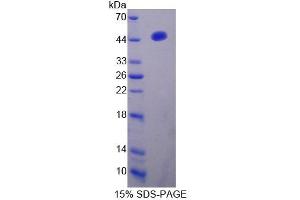 Image no. 1 for Interferon Regulatory Factor 2 (IRF2) (AA 1-349) protein (His tag) (ABIN4989044)