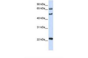 Image no. 1 for anti-UNC Homeobox (UNCX) (AA 74-123) antibody (ABIN6739205) (UNCX antibody  (AA 74-123))