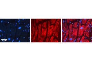 Rabbit Anti-PDHB Antibody   Formalin Fixed Paraffin Embedded Tissue: Human heart Tissue Observed Staining: Cytoplasmic Primary Antibody Concentration: 1:100 Other Working Concentrations: 1:600 Secondary Antibody: Donkey anti-Rabbit-Cy3 Secondary Antibody Concentration: 1:200 Magnification: 20X Exposure Time: 0. (PDHB antibody  (N-Term))
