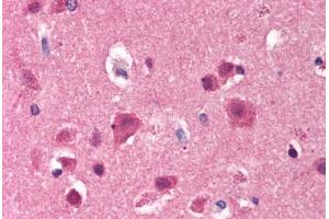 Human Brain, Cortex (formalin-fixed, paraffin-embedded) stained with FYN antibody ABIN239824 at 5 ug/ml followed by biotinylated anti-mouse IgG secondary antibody ABIN481714, alkaline phosphatase-streptavidin and chromogen.