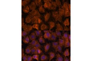 Immunofluorescence analysis of C6 cells using NXN antibody (ABIN7269054) at dilution of 1:100. (NXN antibody  (AA 100-280))