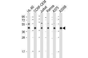 Western Blotting (WB) image for anti-Major Histocompatibility Complex, Class I, B (HLA-B) (AA 62-90), (N-Term) antibody (ABIN652557)
