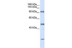 WB Suggested Anti-AARS Antibody Titration:  0. (AARS antibody  (N-Term))
