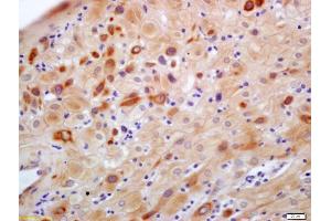 Formalin-fixed and paraffin embedded human placenta labeled with Anti-C1GALT1 Polyclonal Antibody, Unconjugated (ABIN1387755) at 1:200 followed by conjugation to the secondary antibody and DAB staining (C1GALT1 antibody  (AA 185-220))