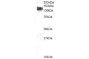 Image no. 1 for anti-Cas-Br-M (Murine) Ecotropic Retroviral Transforming Sequence (CBL) (AA 893-906) antibody (ABIN292894) (CBL antibody  (AA 893-906))