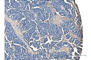 IHC analysis of Serum Amyloid P/APCS using anti-Serum Amyloid P/APCS antibody (ABIN5693182). (APCS antibody  (AA 20-220))