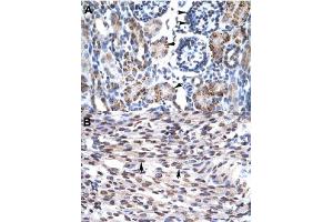 Immunohistochemical staining (Formalin-fixed paraffin-embedded sections) of human kidney (A) and human heart (B) with GFI1B polyclonal antibody  at 4-8 ug/mL working concentration.