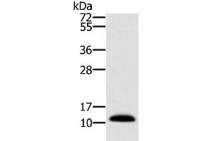 Western Blot analysis of Human prostate tissue using MSMB Polyclonal Antibody at dilution of 1:250 (MSMB antibody)