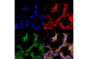 Immunocytochemistry/Immunofluorescence analysis using Rabbit Anti-HSP70 Acetyl Lys77 Polyclonal Antibody (ABIN5650763). (HSP70 antibody  (acLys77) (Atto 594))