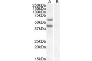 Image no. 1 for anti-Diacylglycerol O-Acyltransferase 2 (DGAT2) (C-Term), (Internal Region) antibody (ABIN374843)