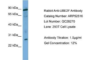 WB Suggested Anti-UBE2F  Antibody Titration: 0. (UBE2F antibody  (Middle Region))