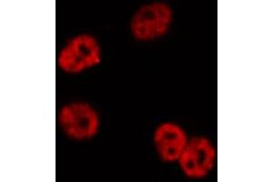Immunofluorescence (fixed cells) (IF/ICC) image for anti-NF-kappa-B inhibitor beta (NFKBIB) (pSer23) antibody (ABIN6256201)