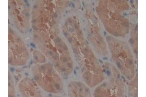 Detection of TEP1 in Human Kidney Tissue using Polyclonal Antibody to Telomerase protein component 1 (TEP1) (TEP1 antibody  (AA 2368-2627))