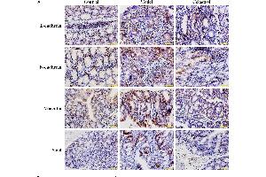 Effects of celastrol (2 mg/kg) on the expression levels of EMT-related proteins in AOM/DSS-treated mice. (SNAI1, SNAI2, SNAI3 (AA 188-264) antibody)