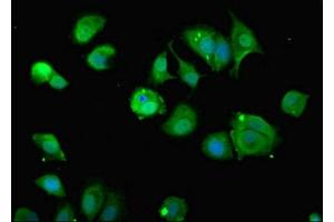 Immunofluorescent analysis of MCF-7 cells using ABIN7164566 at dilution of 1:100 and Alexa Fluor 488-congugated AffiniPure Goat Anti-Rabbit IgG(H+L) (ZDHHC12 antibody  (AA 121-197))