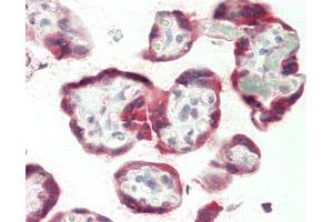 Human Placenta: Formalin-Fixed, Paraffin-Embedded (FFPE) (ANKRD44 antibody  (AA 37-262))