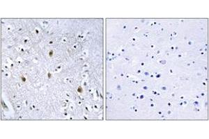 Immunohistochemistry analysis of paraffin-embedded human brain tissue, using IRS-1 (Ab-639) Antibody. (IRS1 antibody  (AA 605-654))
