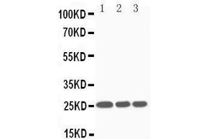 Anti-SOCS3 antibody, Western blotting Lane 1: JURKAT Cell Lysate Lane 2: CEM Cell Lysate Lane 3: RAJI Cell Lysate