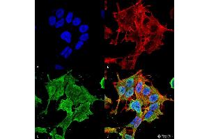 Immunocytochemistry/Immunofluorescence analysis using Mouse Anti-ASIC1 Monoclonal Antibody, Clone S271-44 . (ASIC1 antibody  (AA 460-526))
