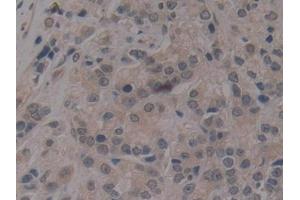Immunohistochemistry (IHC) image for anti-Nucleoporin 210kDa (NUP210) (AA 1288-1449) antibody (ABIN7442474)