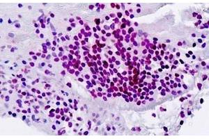 Human Spleen: Formalin-Fixed, Paraffin-Embedded (FFPE) (SPI1 antibody  (AA 217-246))