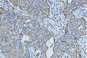 IHC analysis of Cytokeratin 5 using anti-Cytokeratin 5 antibody (ABIN7602992).