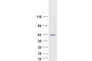 Validation with Western Blot