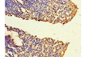 Immunohistochemistry of paraffin-embedded human tonsil tissue using ABIN7165586 at dilution of 1:100 (FNTB antibody  (AA 1-300))