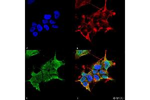 Immunocytochemistry/Immunofluorescence analysis using Mouse Anti-GABA-A Receptor Alpha4 Monoclonal Antibody, Clone S398A-34 . (GABRA1 antibody  (AA 410-450) (FITC))