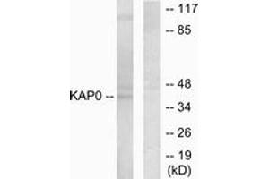 Western blot analysis of extracts from HepG2 cells, using KAP0 Antibody.