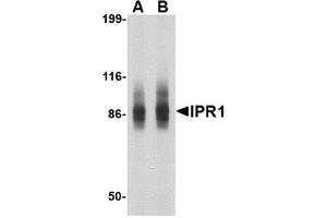 Western blot analysis of IPR1 in SW480 cell lysate with IPR1 antibody at (A) 1 and (B) 2 μg/ml. (SP110 antibody  (N-Term))