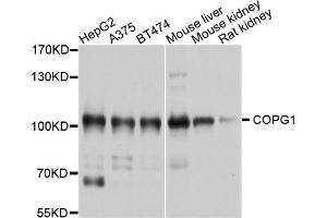Western blot analysis of extracts of various cell lines, using COPG1 antibody (ABIN4903348) at 1:1000 dilution. (COPG antibody)