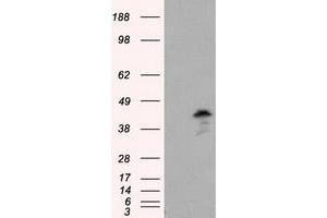 Western Blotting (WB) image for anti-Induced Myeloid Leukemia Cell Differentiation Protein Mcl-1 (MCL1) antibody (ABIN1499337) (MCL-1 antibody)