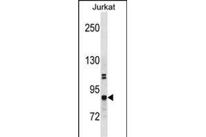 CHUK Antibody (N-term) (ABIN1881203 and ABIN2838746) western blot analysis in Jurkat cell line lysates (35 μg/lane). (IKK alpha antibody  (N-Term))