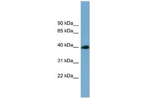WB Suggested Anti-CXorf9 Antibody Titration: 0. (SASH3 antibody  (N-Term))