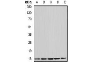 Western blot analysis of Uev1A expression in HepG2 (A), Hela (B), mouse brain (C), rat liver (D), rat spleen (E) whole cell lysates.