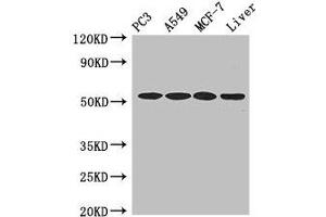 Western Blot Positive WB detected in: PC-3 whole cell lysate, A549 whole cell lysate, MCF-7 whole cell lysate, , Mouse liver tissue All lanes: IRF6 antibody at 4 μg/mL Secondary Goat polyclonal to rabbit IgG at 1/50000 dilution Predicted band size: 54, 42 kDa Observed band size: 54 kDa (IRF6 antibody  (AA 43-285))