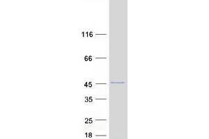 Validation with Western Blot (ARPC1A Protein (Myc-DYKDDDDK Tag))