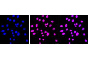 anti-PRP4 Pre-mRNA Processing Factor 4 Homolog (PRPF4) antibody