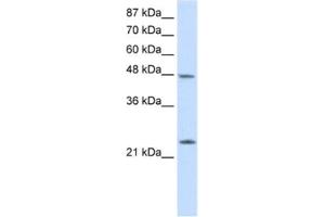 Western Blotting (WB) image for anti-Chromobox Homolog 6 (CBX6) antibody (ABIN2461846)