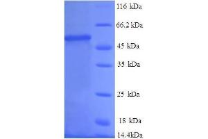 Proteasome (Prosome, Macropain) Subunit, beta Type, 1 (PSMB1) (AA 29-241), (full length) protein (GST tag)