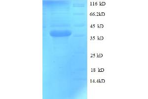 SDS-PAGE (SDS) image for 3-hydroxybutyrate Dehydrogenase, Type 1 (BDH1) (AA 47-343) protein (His tag) (ABIN5709131) (BDH1 Protein (AA 47-343) (His tag))