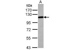 WB Image Sample (30 ug of whole cell lysate) A: Jurakt 7. (alpha Adducin antibody)