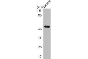 Western Blot analysis of COLO205 cells using LPD lipase Polyclonal Antibody (Lipase I antibody  (Internal Region))