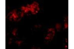 Immunofluorescence of Bmf in human kidney tissue with AP30156PU-N Bmf antibody at 10 μg/ml. (BMF antibody  (C-Term))