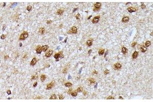 Immunohistochemistry of paraffin-embedded Rat brain using KIAA1429 Polyclonal Antibody at dilution of 1:100 (40x lens).
