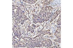 IHC analysis of SAP130 using anti-SAP130 antibody (ABIN7601247). (SAP130 antibody  (AA 309-913))