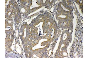 IHC analysis of MAVS using anti-MAVS antibody . (MAVS antibody  (AA 34-96))